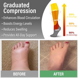 Compression Socks for Women & Men (3 pairs) - Better Blood Flow, Nurses-Best Support for Running, Hiking, Recovery(Large/X-Large,Assorted6)