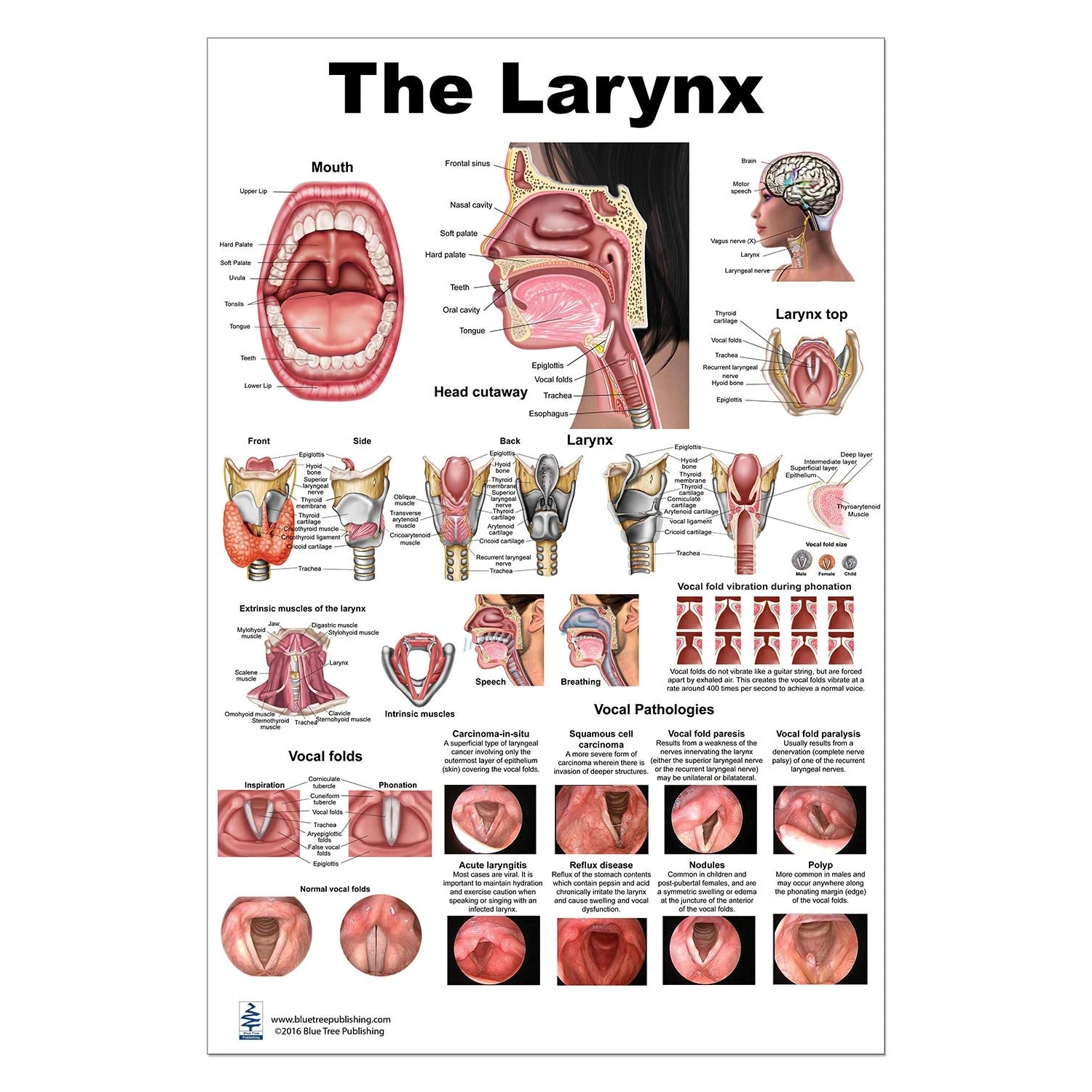 Blue Tree Publishing Larynx LP Poster, voice, education, vocal folds ...