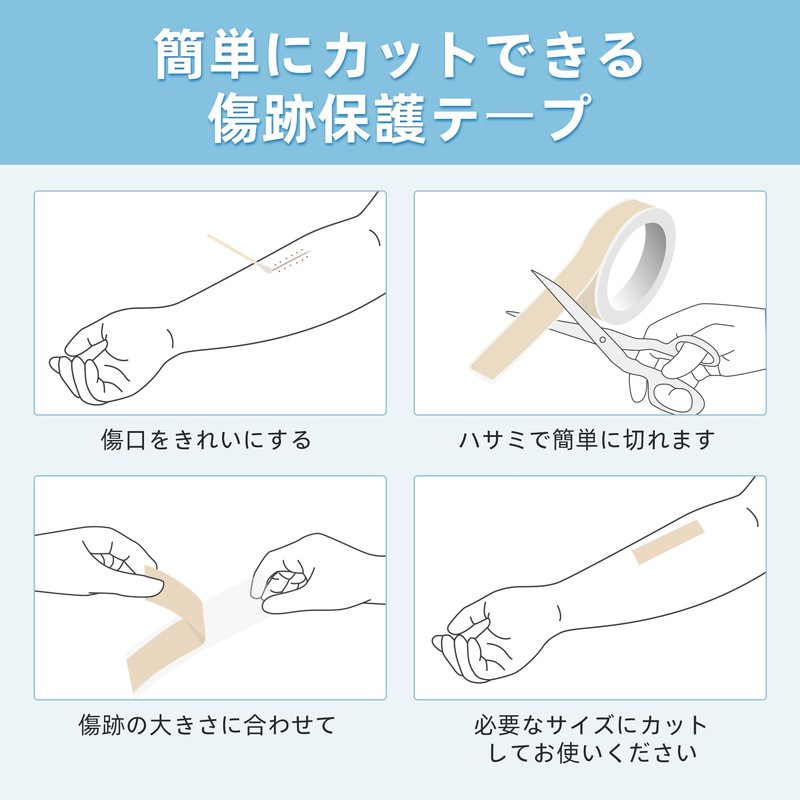URAY 【Recommended by Beauty Dermatologists】Caesarean Section Wound Tape Keloid Tape