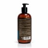 Charle Shampoo Control Caspa Sales Parabenos Extracto Aloe Vera Ayuda