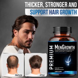 NutraPro Mens Hair Growth-Hair Vitamins For Men. Anti Hair Loss Supplement.