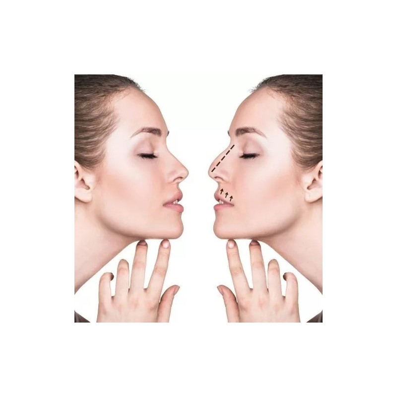 Nose Up Respingador Corrector Nariz Endereza Levanta Perfila Eficaz