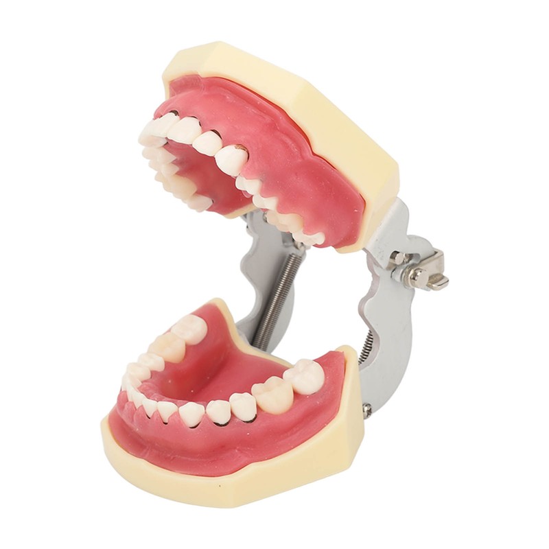 Periodontal Disease Teeth Resin Model Dental Demonstration Teeth Model for