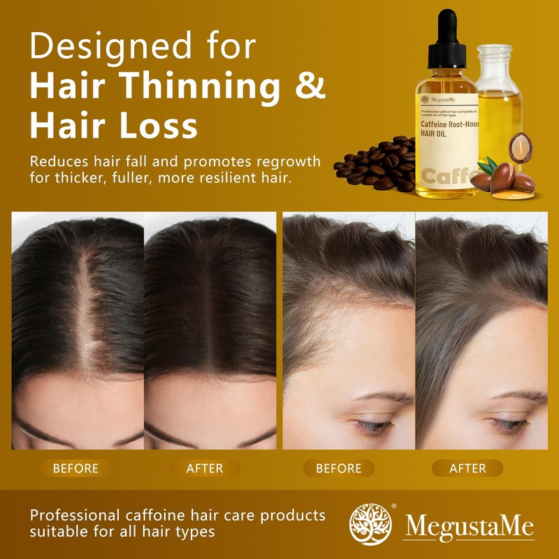 Caffeine Root-Nourishing Hair Oil - Block DHT, Activate Follicles, Extend