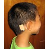 Ear Gear Baha Mono – Protect Baha from Dirt, Sweat,
