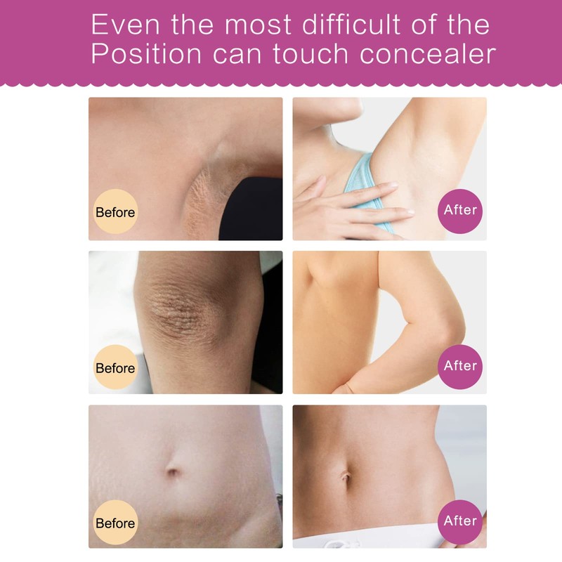 IFUDOIT Whitening Cream for Armpits, Knees, Elbows, Sensitive and Private