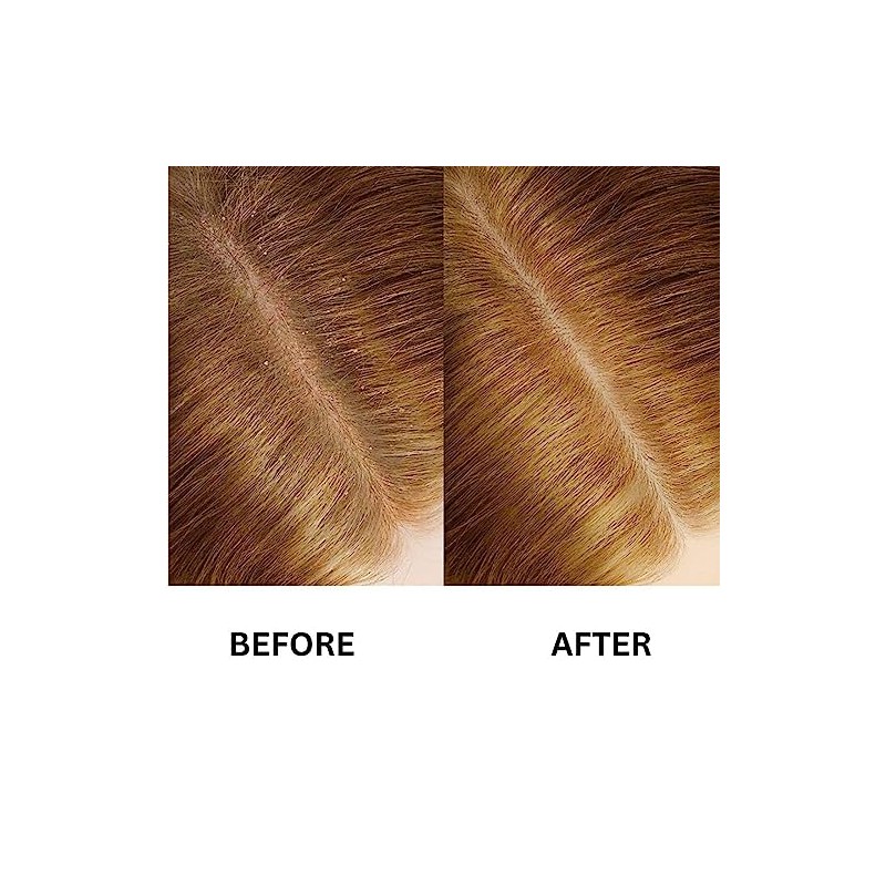 Suero para el Crecimiento del Cabello (30ml) - Fórmula Anti-Frizz