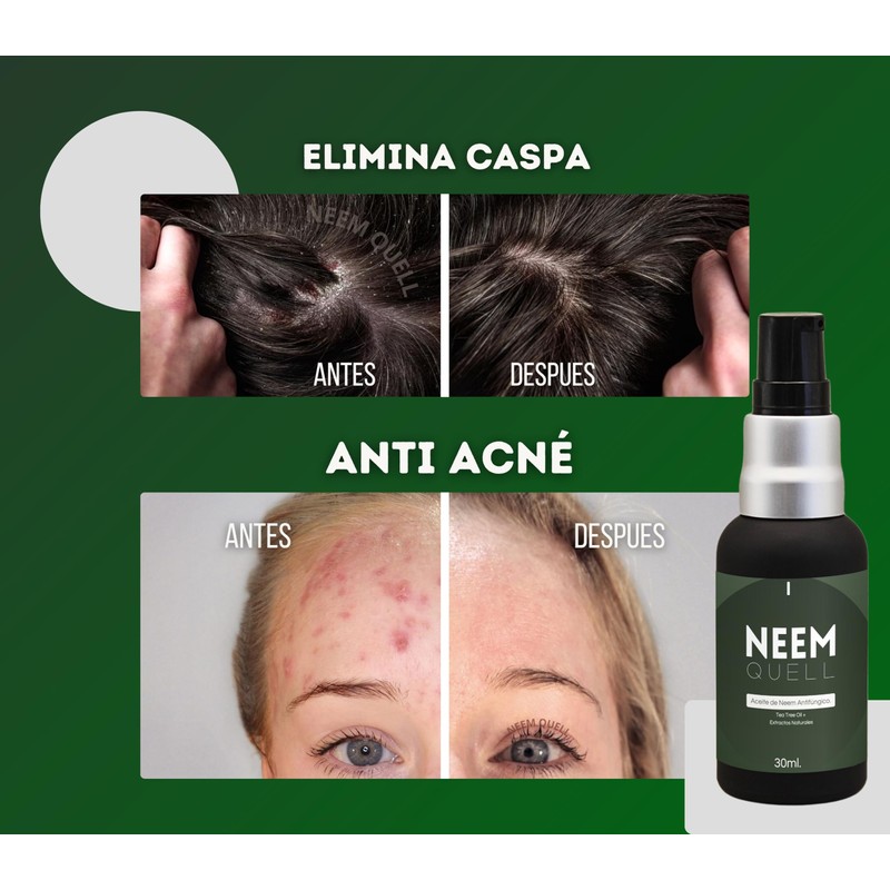 Neem Quell 30ml. - Aceite de Neem Puro 100% Natural