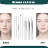Blackhead Remover Tools Set - 5 Double-Ended Pimple Extractor &