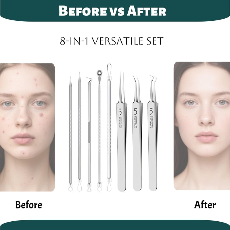 Blackhead Remover Tools Set - 5 Double-Ended Pimple Extractor &