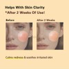 PDRN Salmon DNA Cream for Skin Barrier Support and Improved
