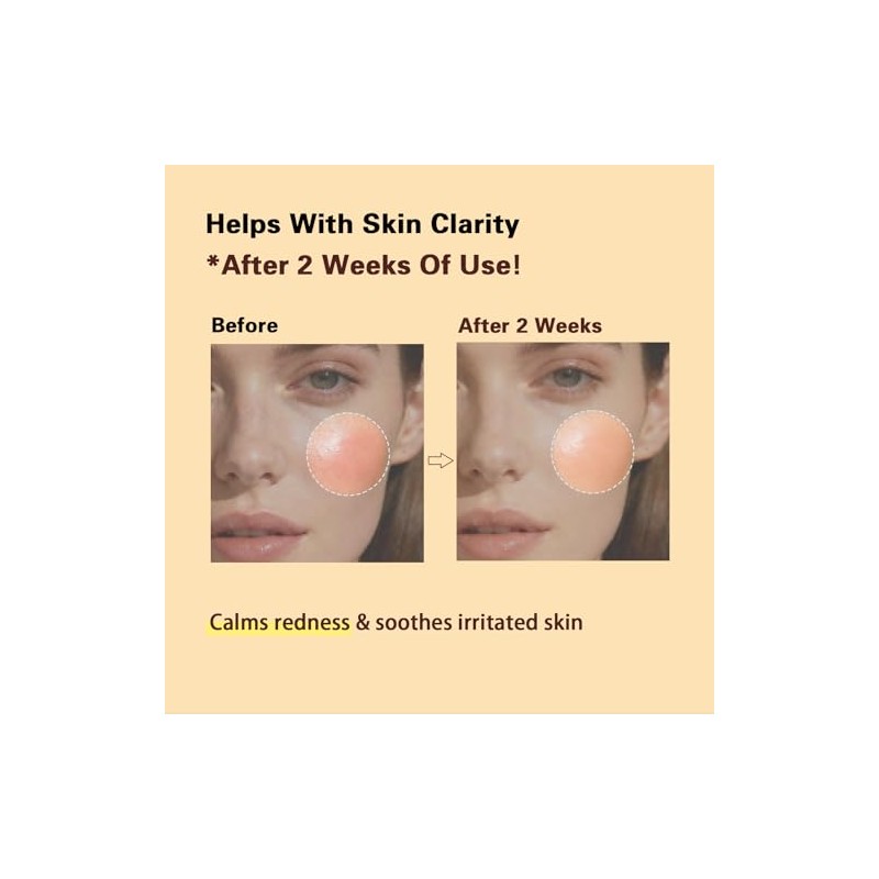 PDRN Salmon DNA Cream for Skin Barrier Support and Improved
