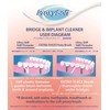 Floss Implant 30pcs