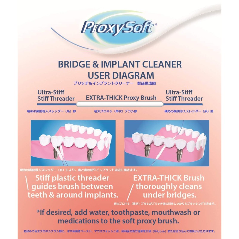 Floss Implant 30pcs