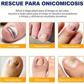 128 Parches Correctores Fortalecedores Uñas Pies Manos Restaura Color