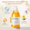QUARXERY Gel de Baño Antiácaros Antiacné Antibacteriano Bacterianos 250ml