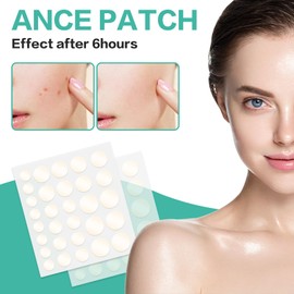 Zrebcley Pimple Patches, Waterproof Natural Hydrocolloid with Tea Tree Oil, Acne Patches, Day and Night Pimple Patches, Invisible & Breathability (Pack of 300)