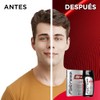 Folcress - Shampoo Fuerza y Grosor, Cabello Delgado, Para Hombre,