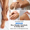 Ebanel Urea Cream 40% plus Salicylic Acid 2%, Foot Cream