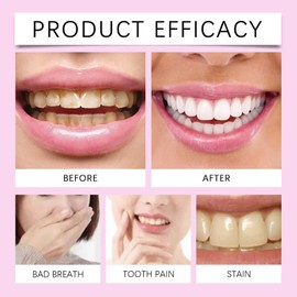 Gentle Teeth Whitening Strips,Professional Teeth Whitening Strips 7 Treatments,Bleaching Teeth Free of Pero/xide for a Radiant Smile,Whitening Strips for Sensitive People,Brighten Teeth Fast