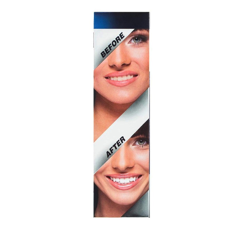 White Glo Accelerator Professional Teeth Whitening Kit with LED Light