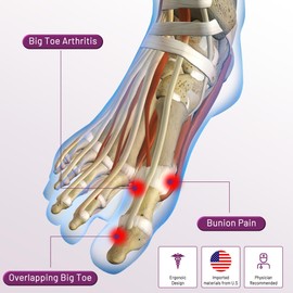 LEOWEER Bunion Corrector Sleeve, Breathable Bunion Big Toe Alignment Splint with Anti-Slip Heel Grip,4 Sizes,Extra Thick Gel Pads & Adjustable Straps for Hallux Valgus Comfort.