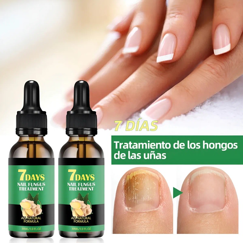 Líquido Para Hongos En Las Uñas-tratamiento Para Uñas