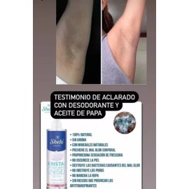 Kit Aclarador De Axilas Aceite De Papa, Desodorante Sheló Na