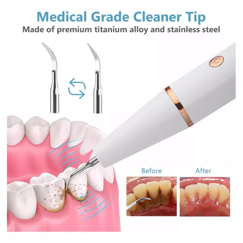 Hikvison Limpiador Dental Eléctrico Para Blanqueamiento Dental