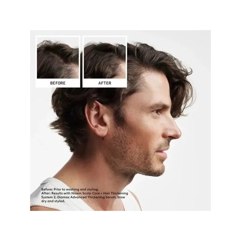 Nioxin Scalp + Hair Thickening System 2 Full Size Kit