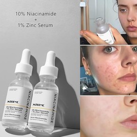 Suero facial de niacinamida 10% + zinc 1% para niñas y mujeres, suero hidratante de niacinamida para el acné, enrojecimiento.