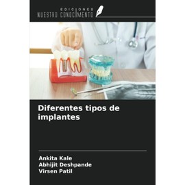 Diferentes tipos de implantes