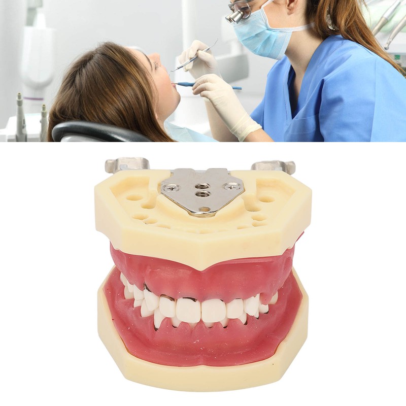 Periodontal Disease Teeth Resin Model Dental Demonstration Teeth Model for