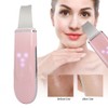 Ultrasonic Skin Scrubber Blackhead Pimple Removal Face Pore Vibration Cleanser