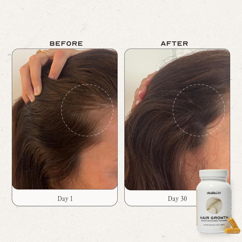 VitableLabs Hair Growth - 60 Capsules