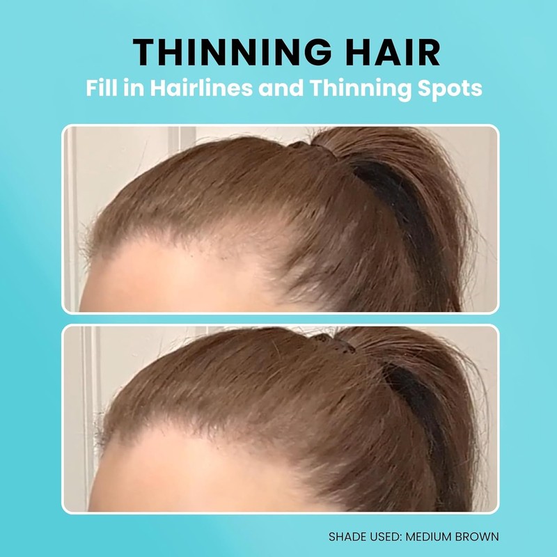 SURETHIK 4-in-1 Premium Hairline Powder Kit - Conceal Thinning Hair,
