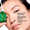 Vichy Normaderm Bha Exfoliating Serum Salicylic Acid Acne Treatment