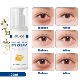 Jasminsalbe Augenringe Jasmin Creme Gegen Tränensäcke Jasmin Salbe Augenringe Aktiv Jasminsalbe Jasminsalbe Augenringe Schlupflider Jasminsalbe Augen Jasmin Augencreme Mit Kollagen Augenmaske