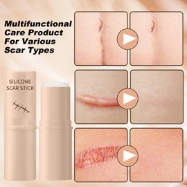 2PCS Scar Solutions Silicone Scar Stick, Silicone Scar Stick, Contains 60% Silicone, Easy-to-Use Stick Design, Manual Massage Applicator for Face and Body, Suitable for All Skin Types