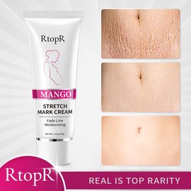 RtopR Mango Crema Antiestrias, Crema Reparadora de Estrías, Prevenir y Atenuar las Estrías, Segura de Usar en el Embarazo