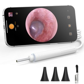 ScopeAround Otoscope with Light, 720P HD Ear Cleaning Camera & 6 LED Lights Ear Scope, Digital Otoscope with Camera, Smart Endoscope, Plug & Play, USB-C Port