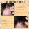 Espuma Anticaída Fortalecedora Capilar + Barba Biotina 60ml