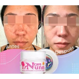 Kit Facial Completo Nunn Care Limpieza Hidratación Y Fps 50