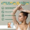 2 Cremas Vitiligo Tratamiento Premium Para La Piel. Todo Tipo