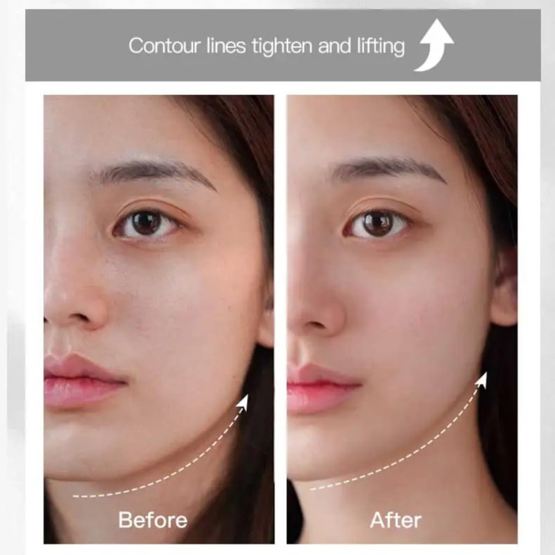 The EMS let a face massager run, 3D face roller