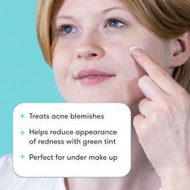 Proactiv Redness Correcting Treatment, Acne Spot Treatment with 1.5% Salicylic Acid, Calms Irritated Skin, Non-Comedogenic, 0.33 oz