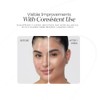 Dotless Gel Tratamiento Focalizado para Imperfecciones y Acné 30 ml