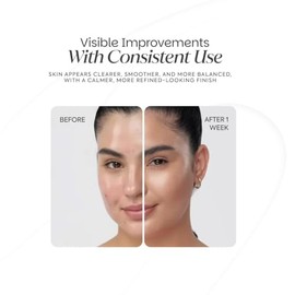 Dotless Gel Tratamiento Focalizado para Imperfecciones y Acné 30 ml