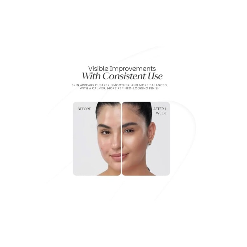 Dotless Gel Tratamiento Focalizado para Imperfecciones y Acné 30 ml