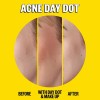 Peace Out Skincare Acne Day Night Duo Parches De Espinil